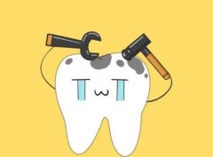 上海根管治疗可以用医保吗？内附根管治疗注意事项